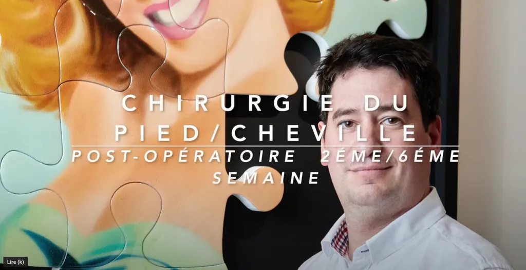 Podcast du Docteur Julien Beldame sur la rééducation de l'avant pied entre la 2e et la 6e semaine après une chirurgie