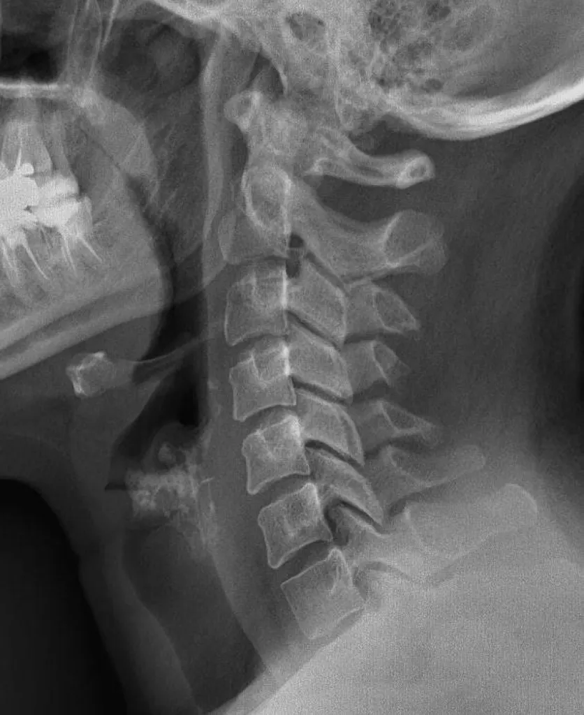 Notre zone d'activité pour ce serviceEchographie abdominal rapide et urgent à Auriol 13390 en centre de radiologie