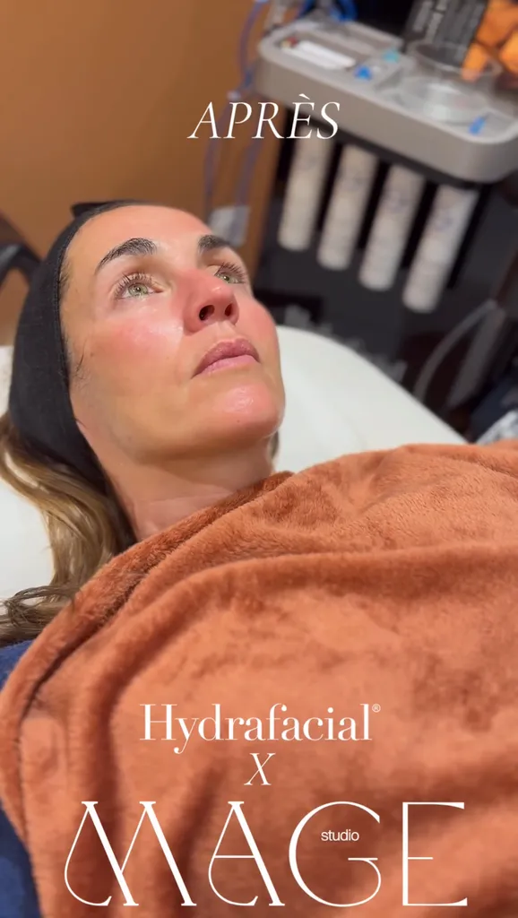 Hydrafacial et radiofréquence Toulouse