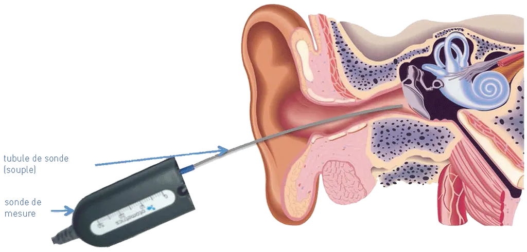 Mieux comprendre dans le bruit : réglage acoustique avancé en Gironde