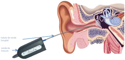 Mieux comprendre dans le bruit : réglage acoustique avancé en Gironde