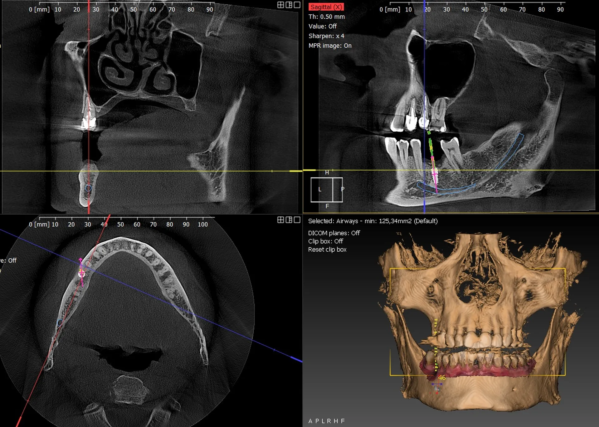 Owandy I-Max 3D XPRO Ceph Meditec Dental à Toulon 83