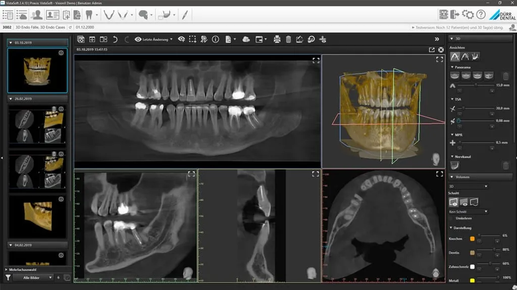 Durr Dental VistaSoft 
