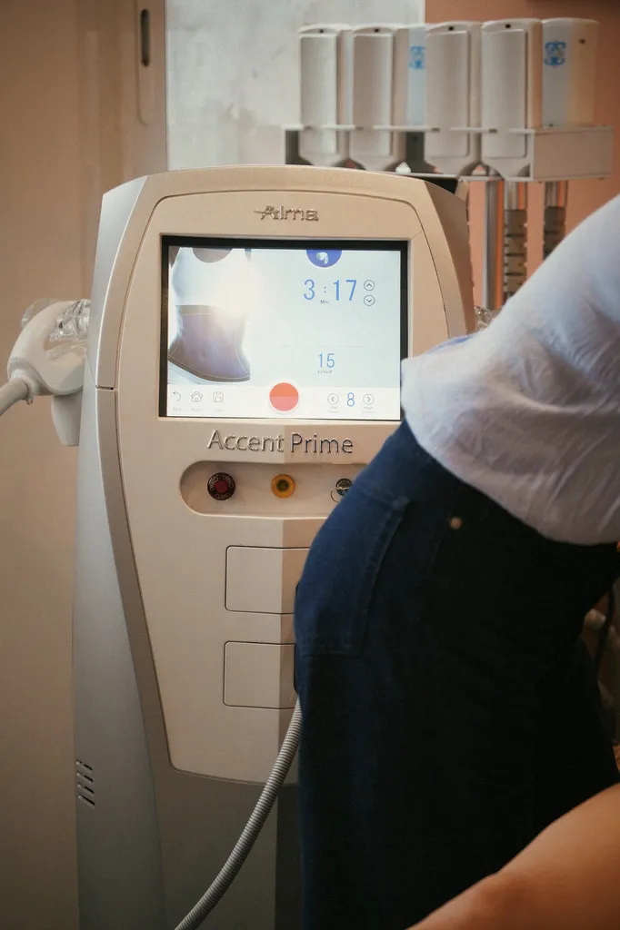 Accent Prime : technologie de pointe pour le body contouring à Toulouse

