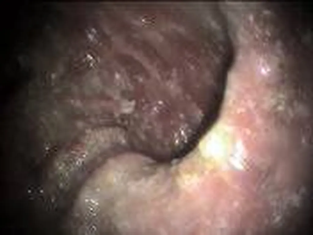 endoscopie chien aire Toulonnaise