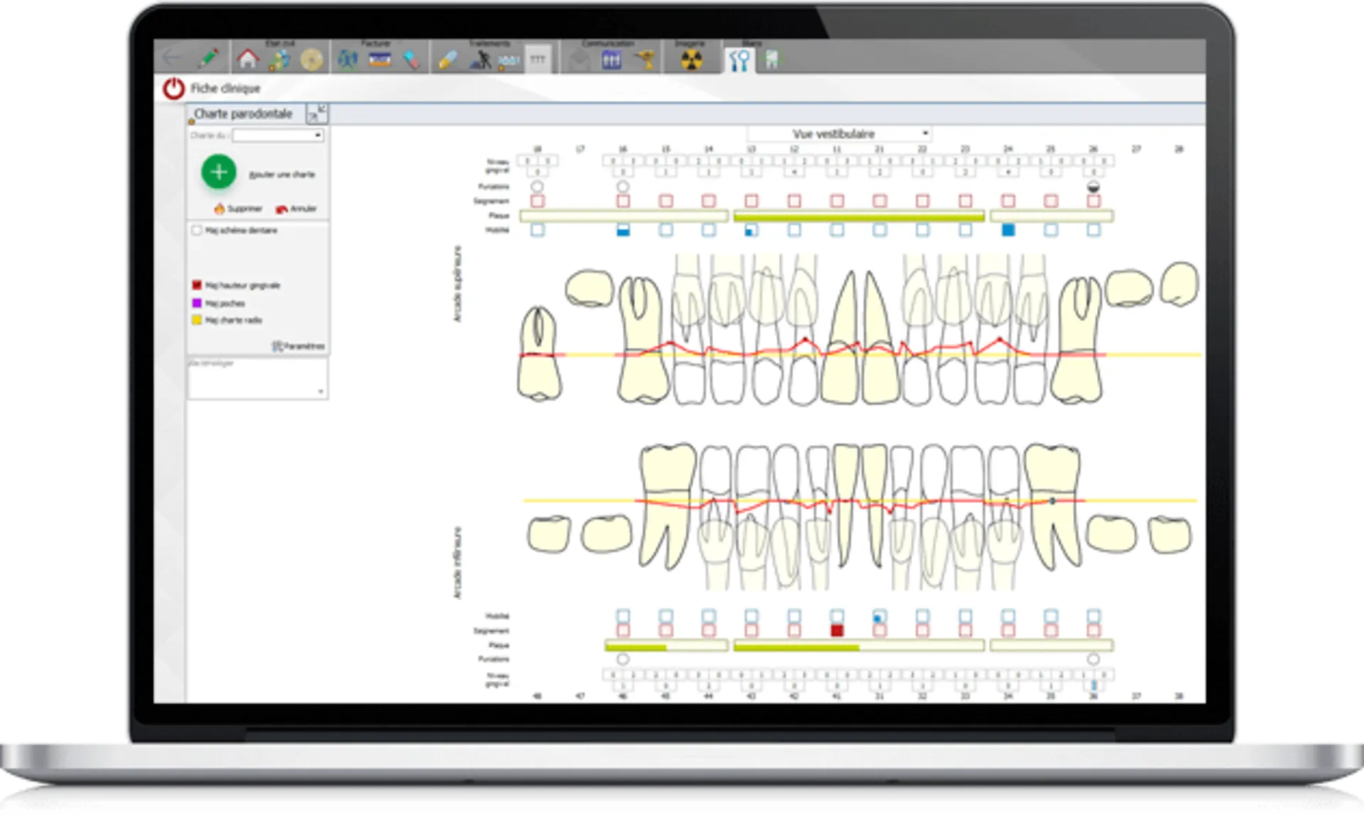 LOGOSw fiche paro Charting Meditec Dental à Toulon 83