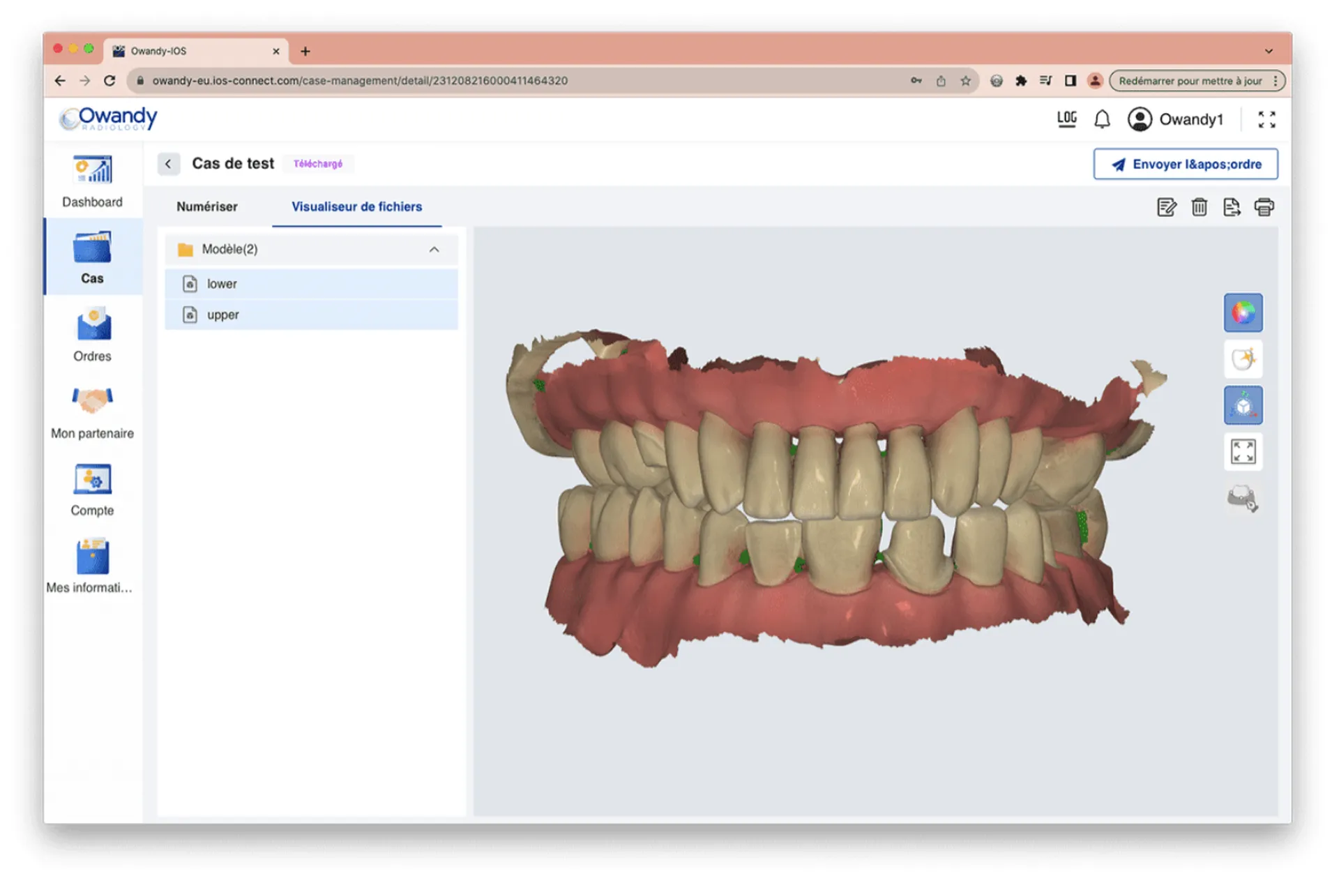 Owandy IOS scanner intra oral, une solution 3D rapide, précise et ergonomique pour moderniser les prises d'empreintes à Avignon