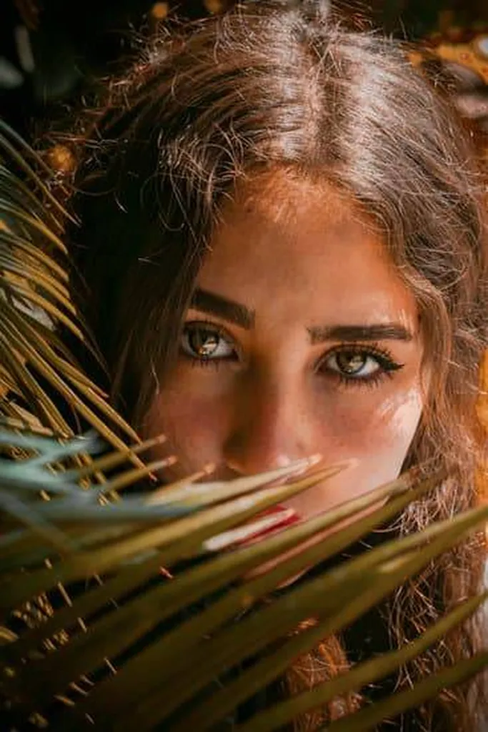 profhilo structura Paris 