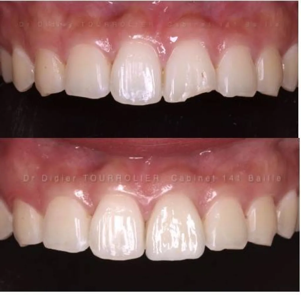 spécialiste dentisterie esthétique la ciotat 13600