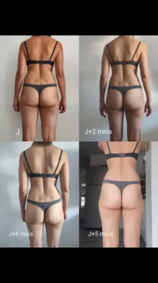Coaching privé en électrostimulation et perte de cellulite à Six Fours