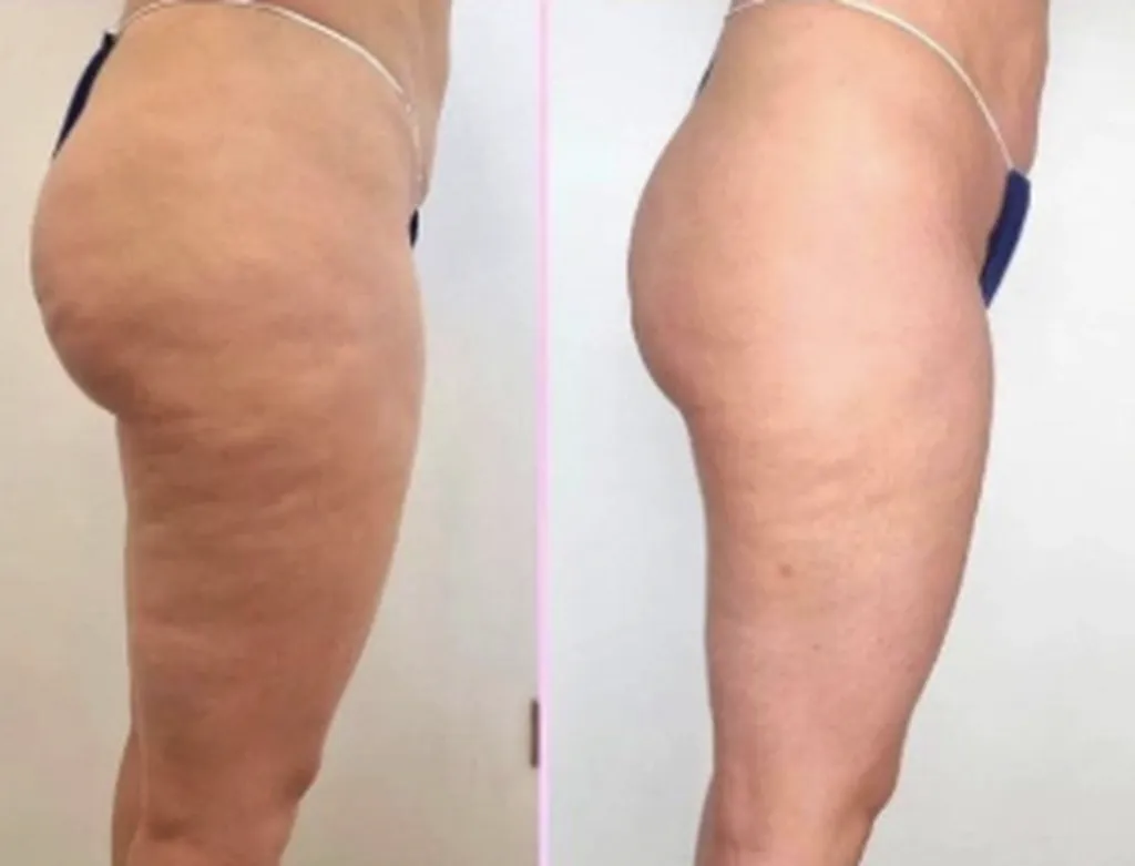 LE PRINTEMPS ARRIVE À GRANDS PAS