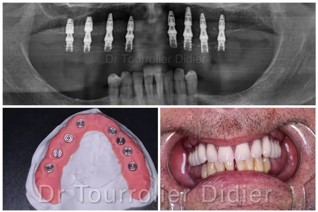 Notre zone d'activité pour ce serviceOrthodontiste pour alignement de dents sans douleur