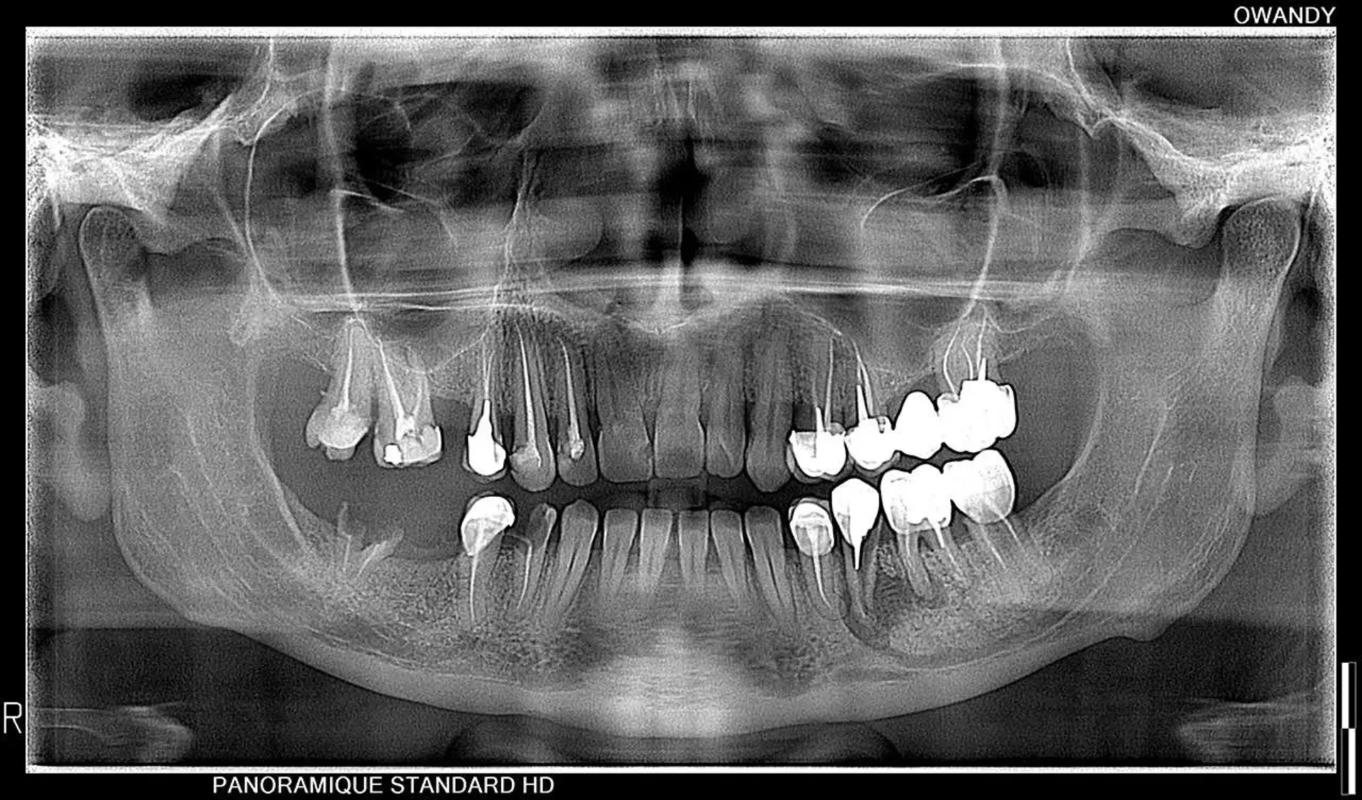 Panoramique Owandy I-Max 2D
