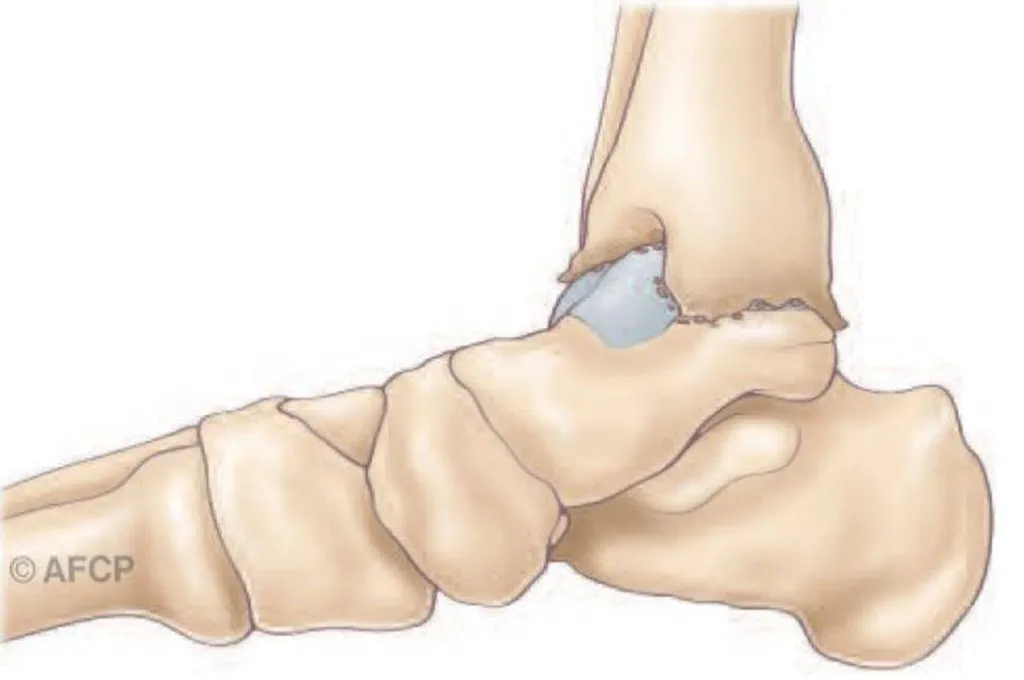 Docteur Julien Beldame, chirurgien orthopédiste, exclusif Pied Cheville, Fondateur de l'Institut de la Cheville et du Pied à Amiens (ICP Amiens), consulte à l'ICP Paris