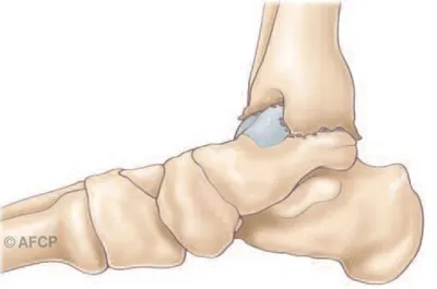 Docteur Julien Beldame, chirurgien orthopédiste, exclusif Pied Cheville, Fondateur de l'Institut de la Cheville et du Pied à Amiens (ICP Amiens), consulte à l'ICP Paris