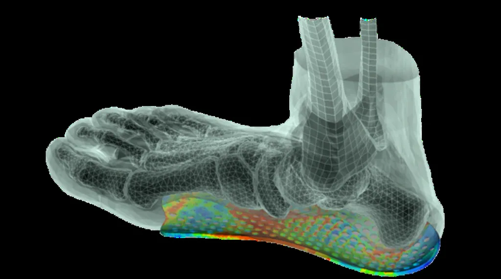 Conception d'orthèses plantaires 3D, en Val-de-Marne, 94