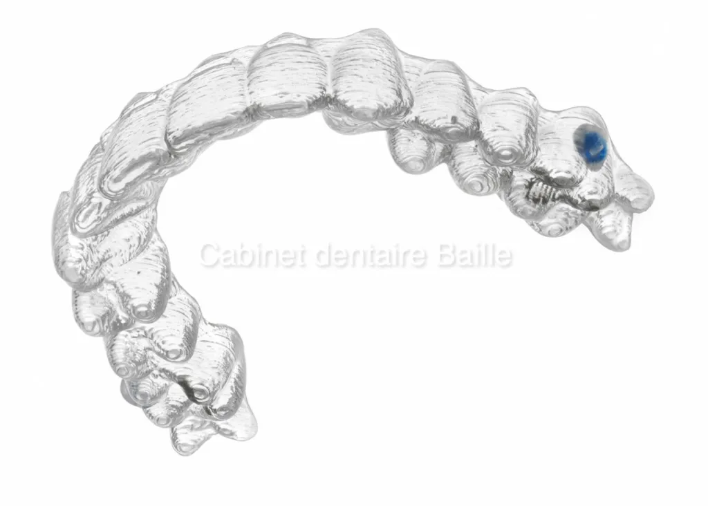 Invisalign Marseille-Coût du traitement-Dr TOURROLIER Didier