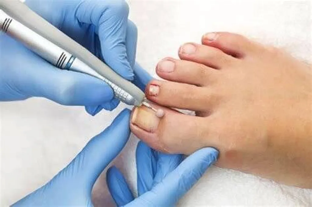 soin de pied pédicurie elbeuf