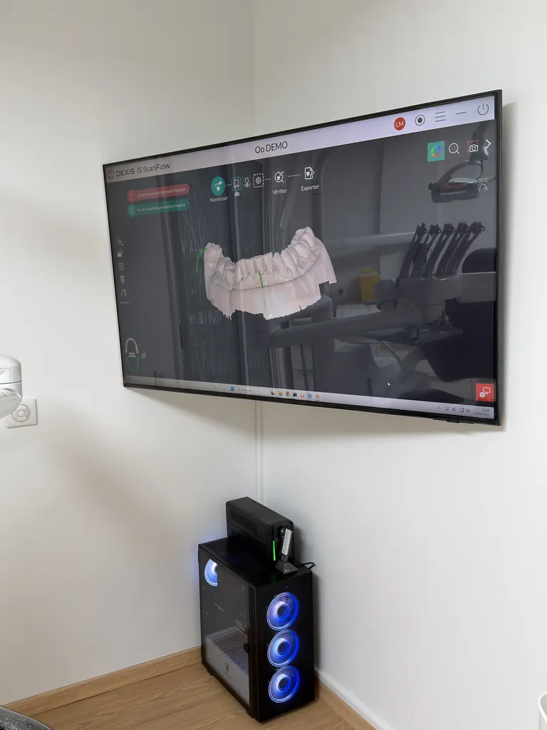 Installation caméra Dexis Imprevo sur TV 55