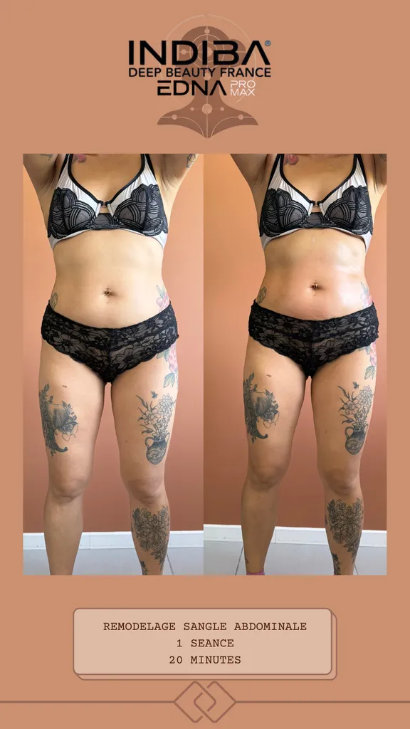 INDIBA et post-partum- radio fréquence- douceur- ventre plat- – Récupération et harmonie du corps chez Mage Studio Toulouse