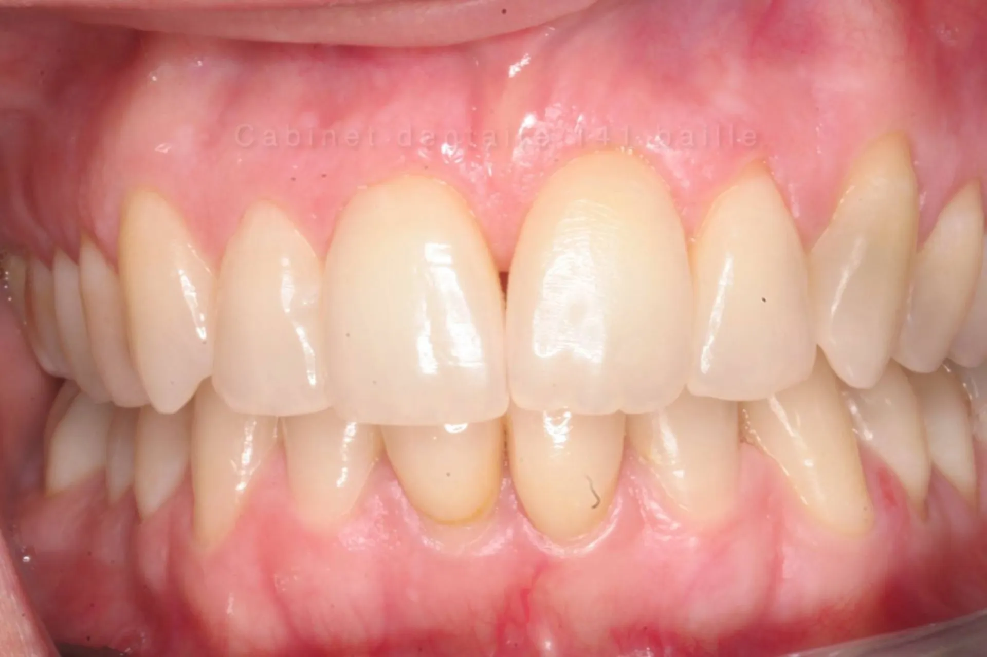 spécialiste soins des gencives à marseille au cabinet dentaire 141 baille 