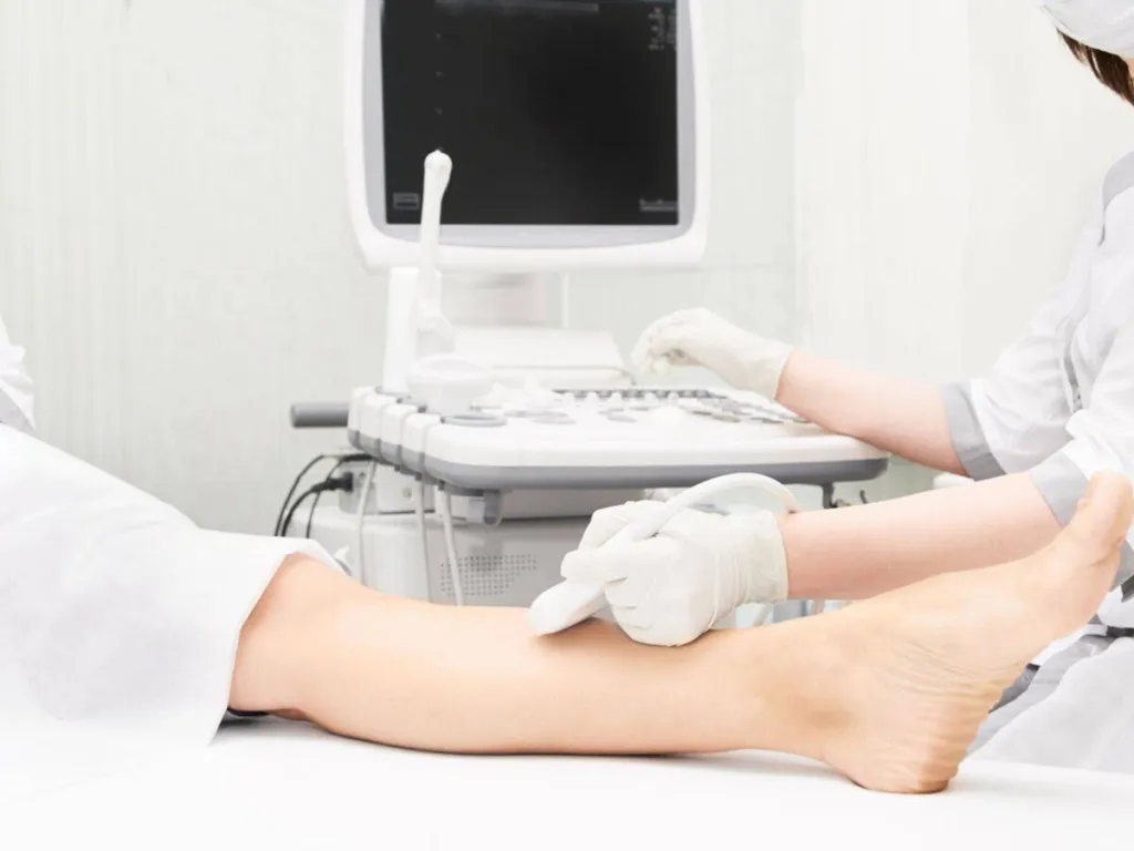 Examen Doppler pour analyser le flux artériel ou veineux, à Marseille