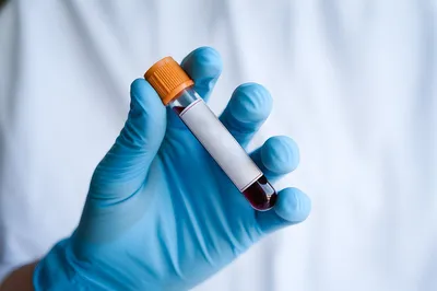 TRANSPORT D'ECHANTILLONS BIOLOGIQUES VERS L'INDE