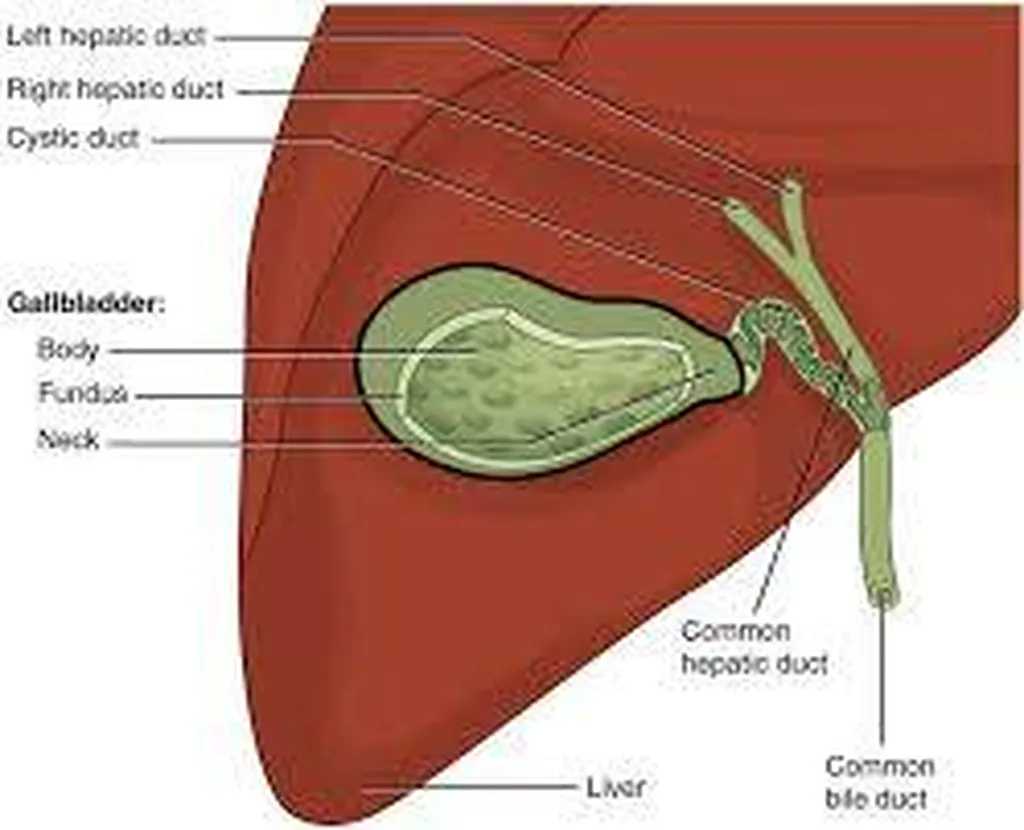 Cholecystectomie, chirurgie des voies biliaires
