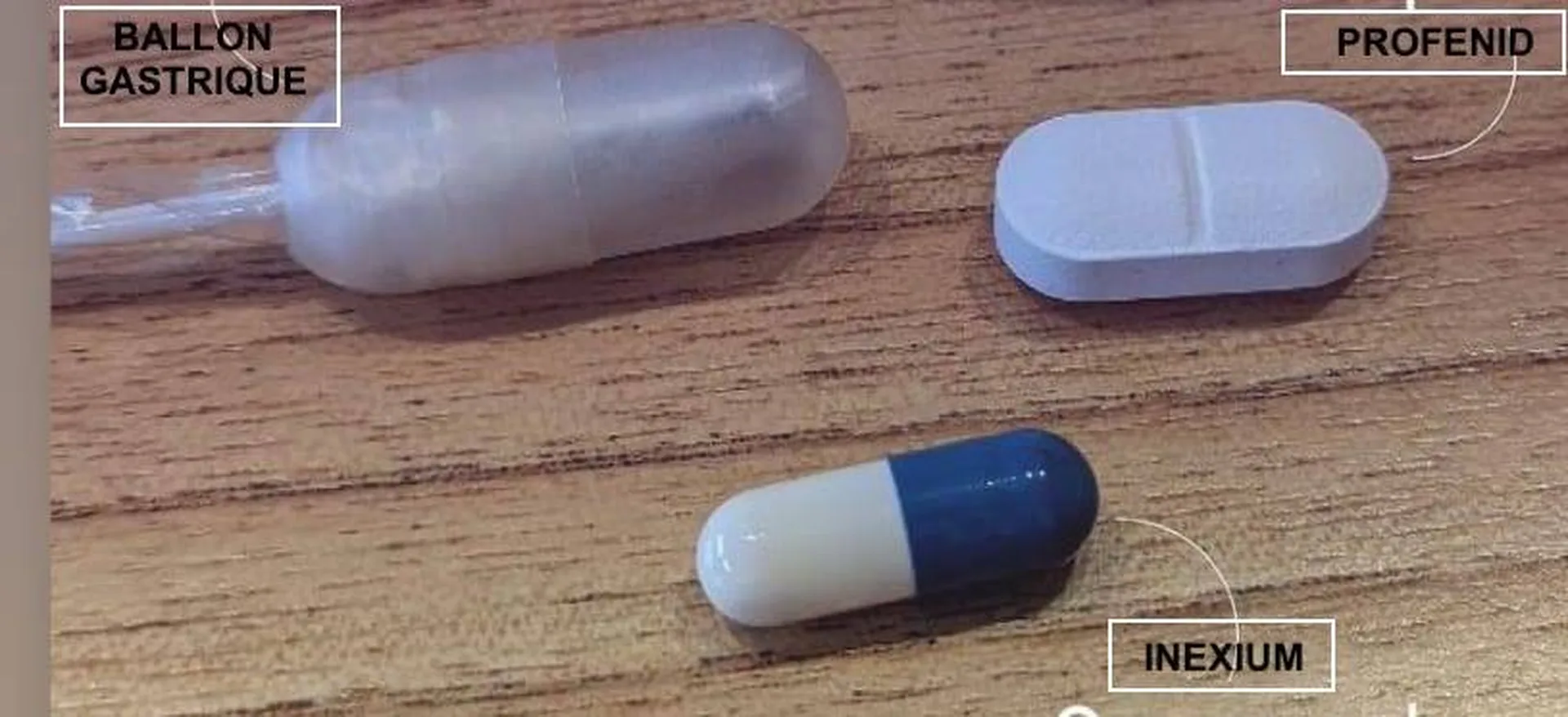 taille capsule ballon gastrique