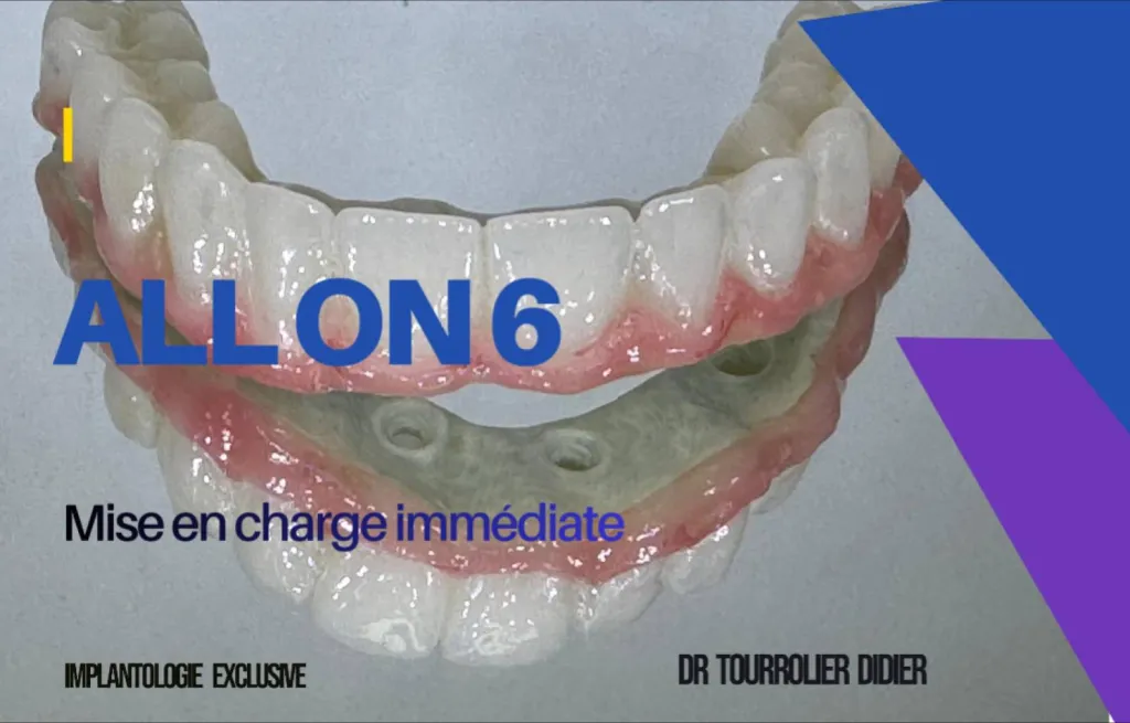 Specialiste technique ALL on 6 Marseille