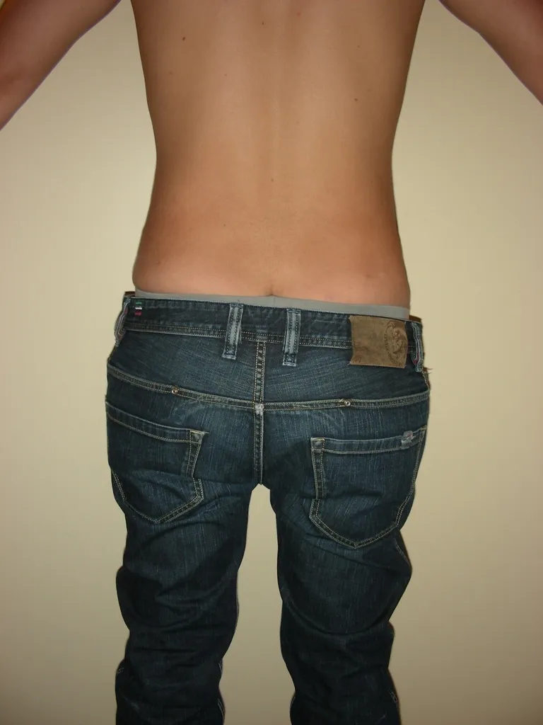 CHIRURGIE DE LA SILHOUETTE CHEZ L'HOMME, LA GYNCOMASTIE ET LE BODYLIFT