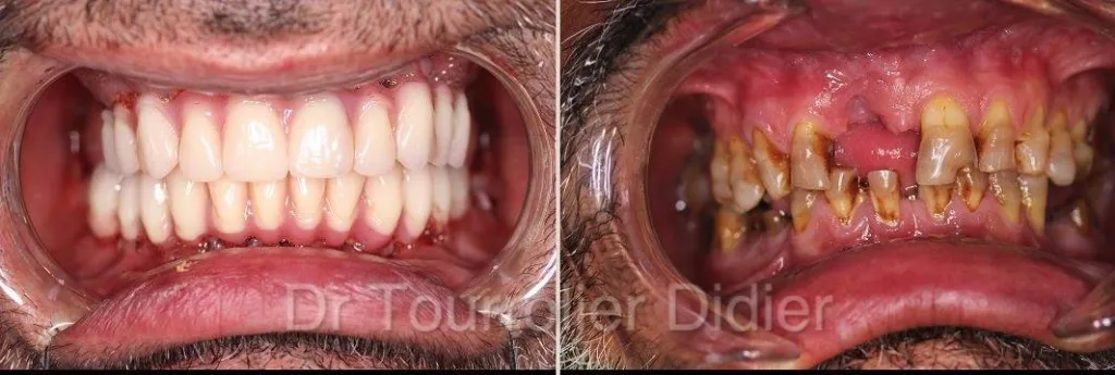 technique all on 6 Marseille