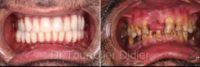 technique all on 6 Marseille