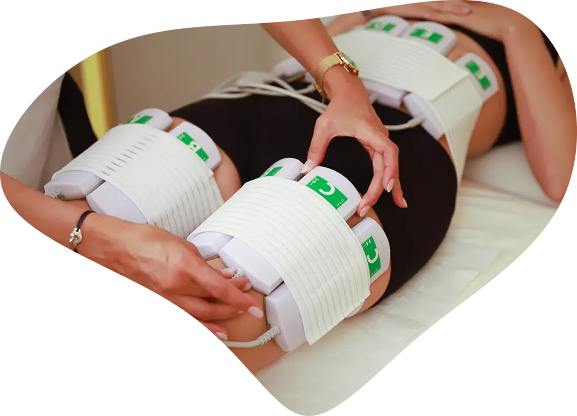 Soin pour la cellulite adipeuse et aqueuse