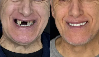 specialiste All on 6 Arles en  provence Bouches du rhône