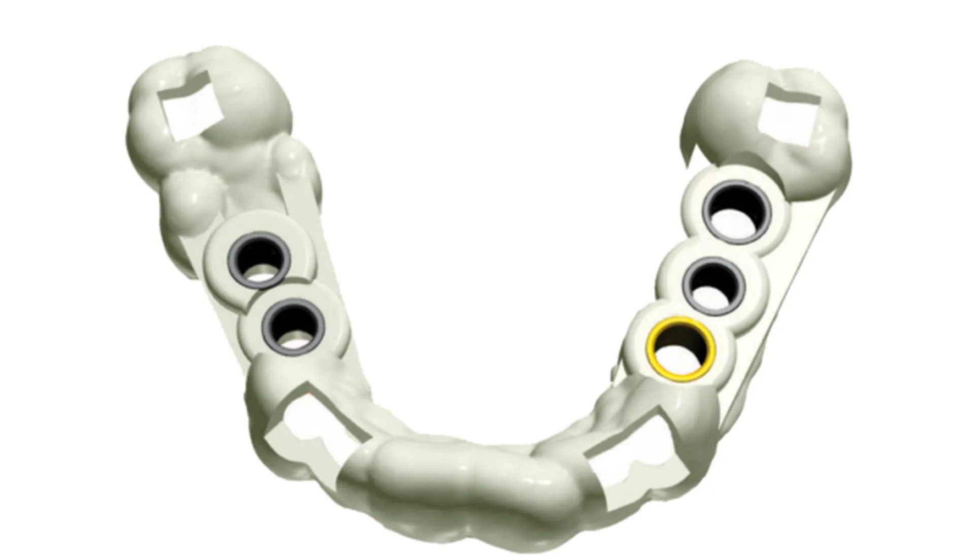 Owandy Quickvision Guide chirurgical Meditec Dental à Toulon 83