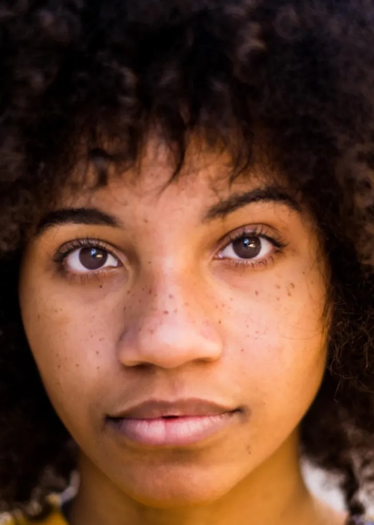 toxine technique one21 botox 