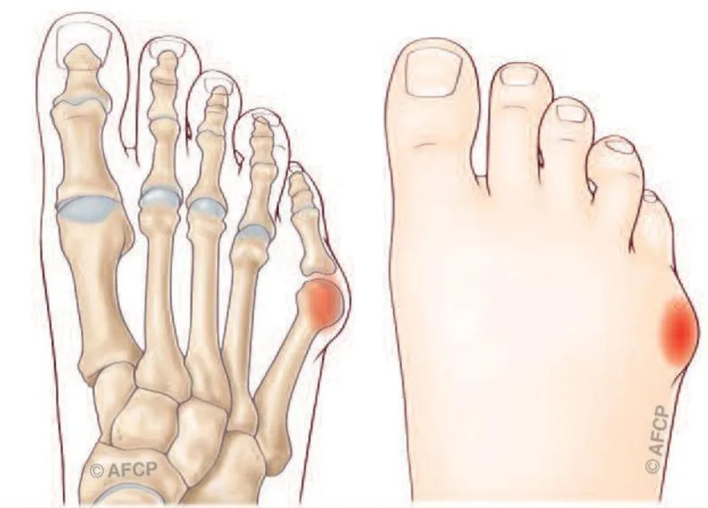 Docteur Julien Beldame, chirurgien orthopédiste, exclusif Pied Cheville, Fondateur de l'Institut de la Cheville et du Pied à Amiens (ICP Amiens), consulte à l'ICP Paris