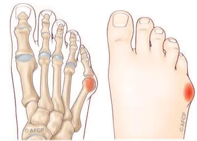 Docteur Julien Beldame, chirurgien orthopédiste, exclusif Pied Cheville, Fondateur de l'Institut de la Cheville et du Pied à Amiens (ICP Amiens), consulte à l'ICP Paris