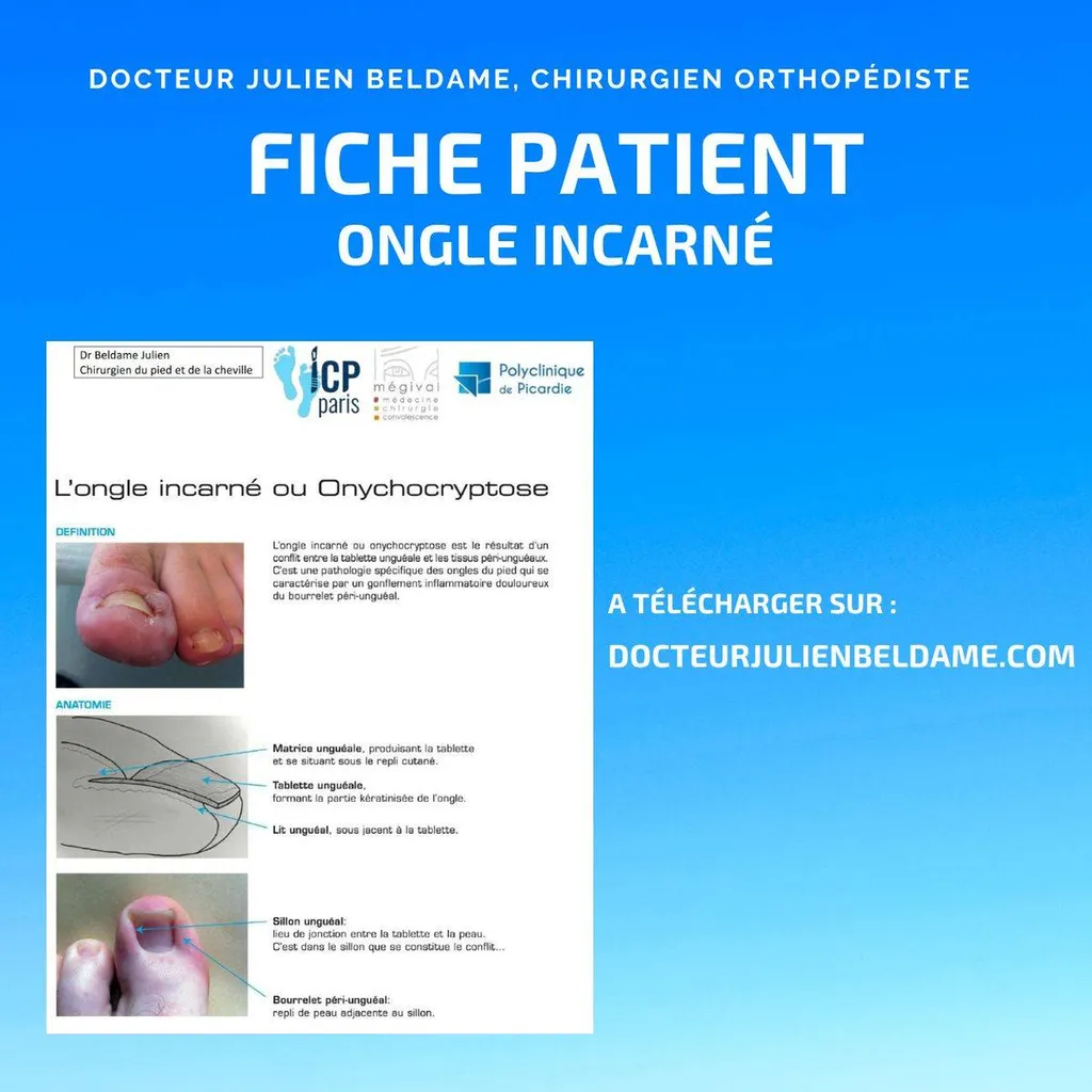 Fiche patient 