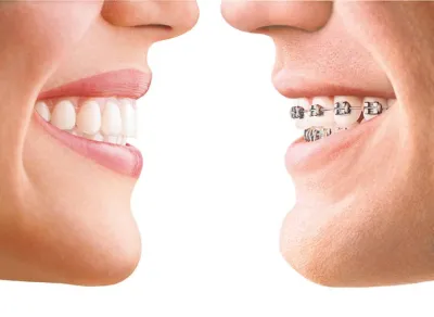 specialiste invisalign marseille
