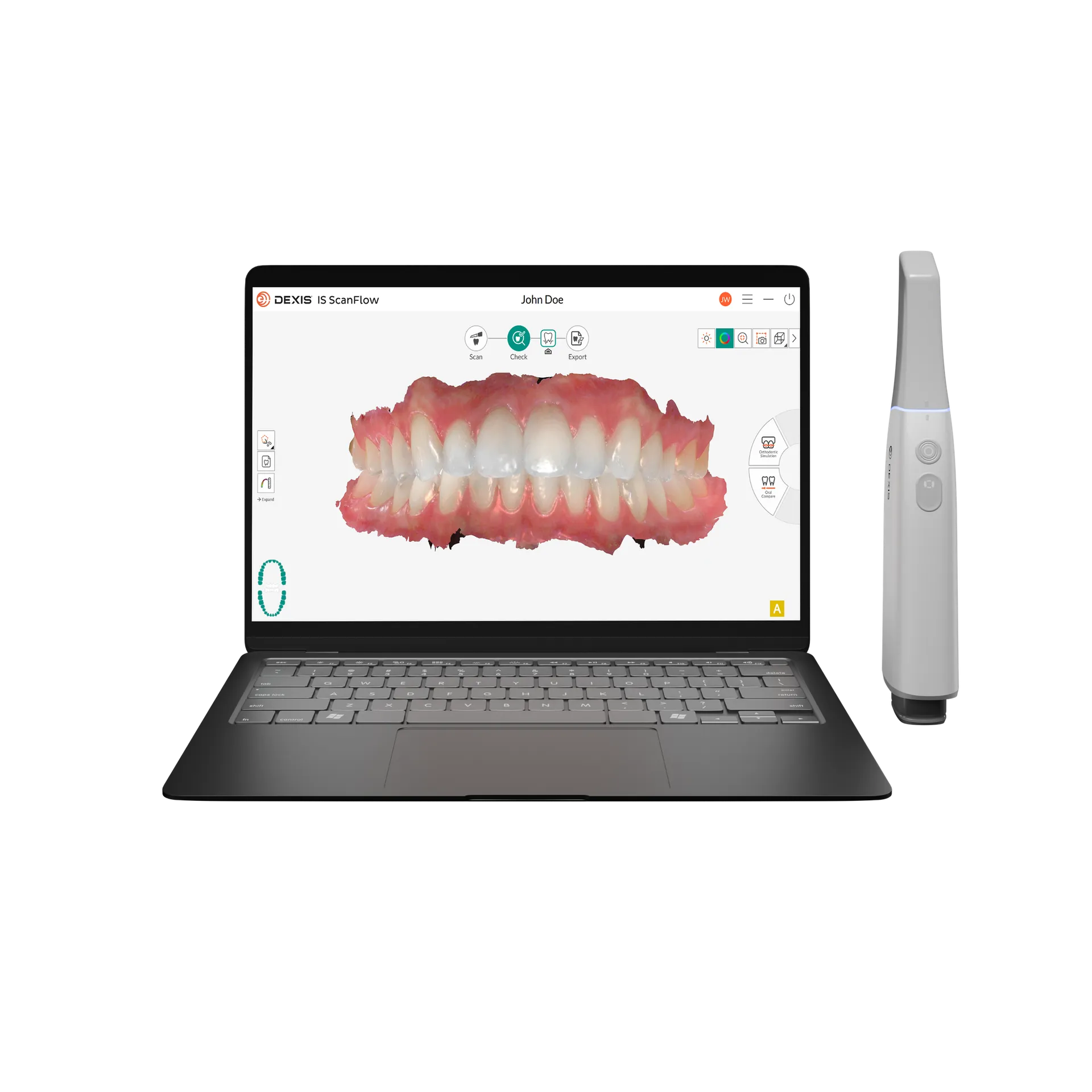 Nouveau scanner intra-oral DEXIS Imprevo Nice 06