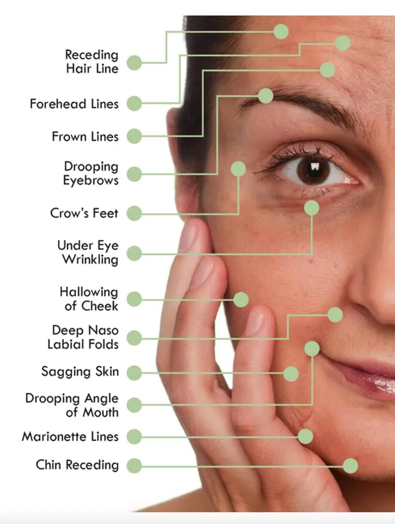 profhilo morpheus botox 