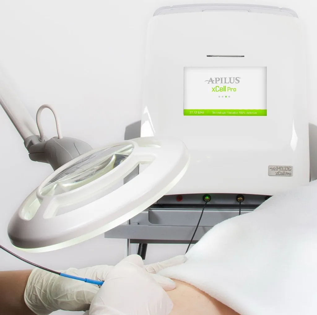 Epilation électrique Toulouse