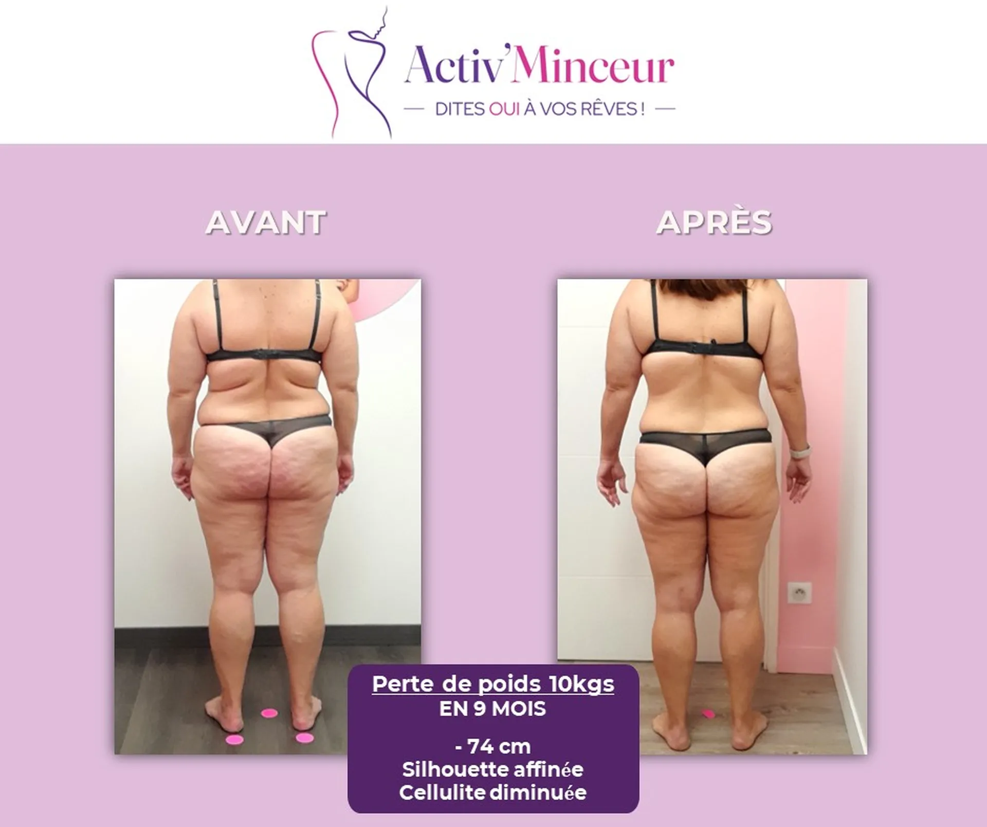 Emilie   49 ans  -74 cm  -10 kg en 9 mois 