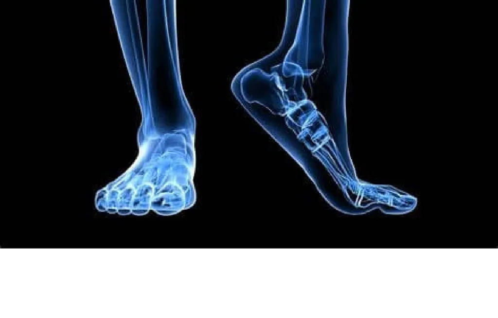 Le Dispositif Transitoire d’Aide à la Cicatrisation du Pied (DTACP) est un appareillage conçu pour soulager une lésion du pied, comme un ulcère plantaire lié au diabète 