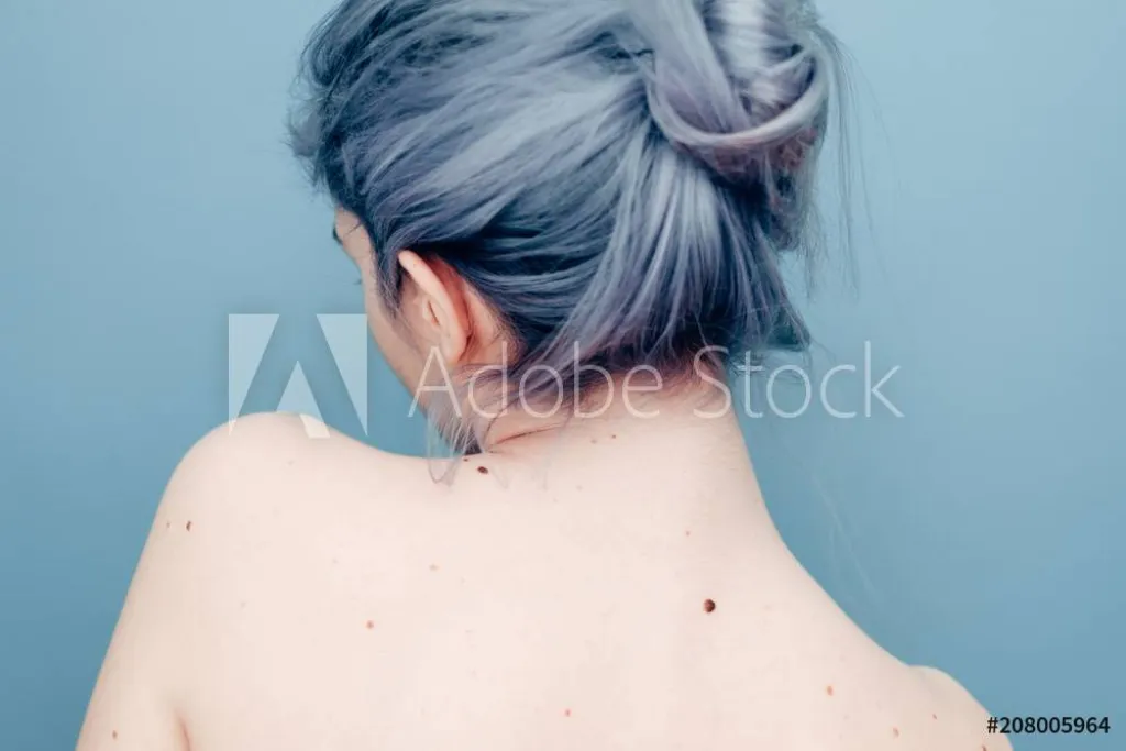 CHRISTIAN MAHODI ATTACHES CHIGNOS MARSEILLE 4EME ART