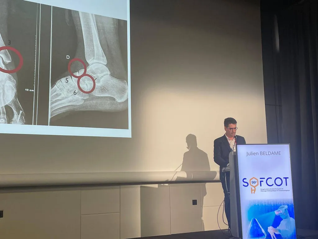 Docteur Julien Beldame au congrès de la SOFCOT