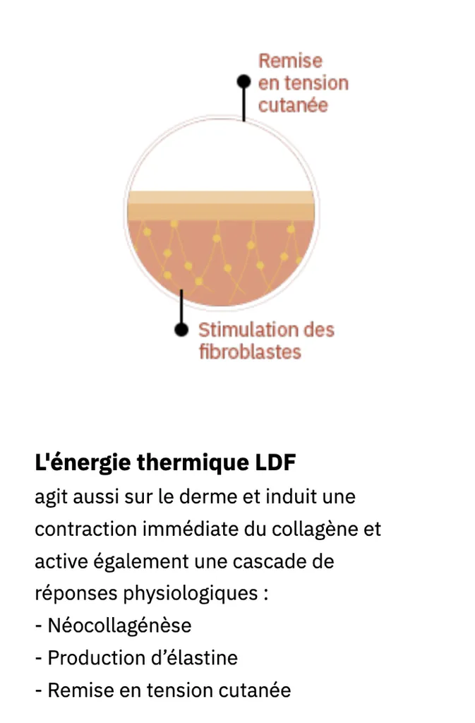 L'énergie thermique LDF