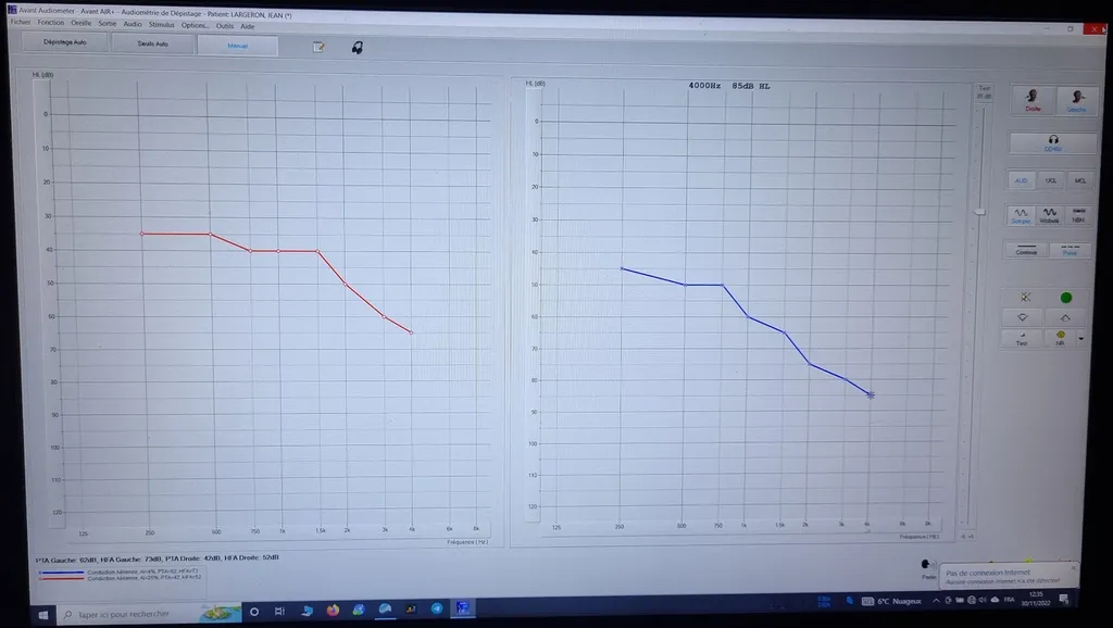 Fréquence de l'acouphène